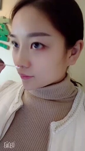做完线雕鼻子的感觉