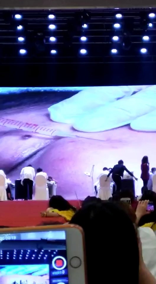 凹陷痘坑填充技术