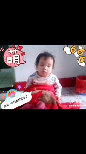 宝宝你的几天没睡觉了困成这样子
