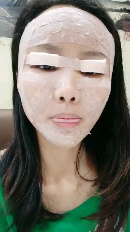 自体脂肪全脸填充第一天