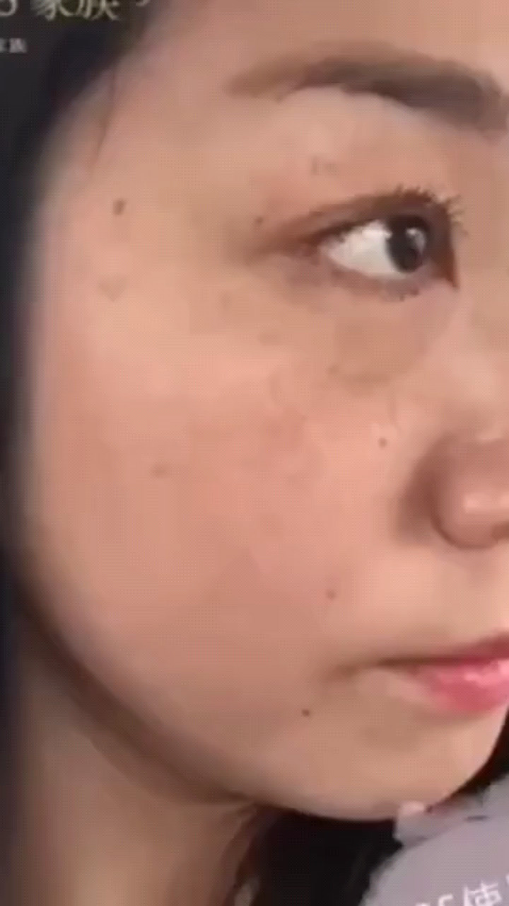 看这个美女从一开始很多斑点，暗